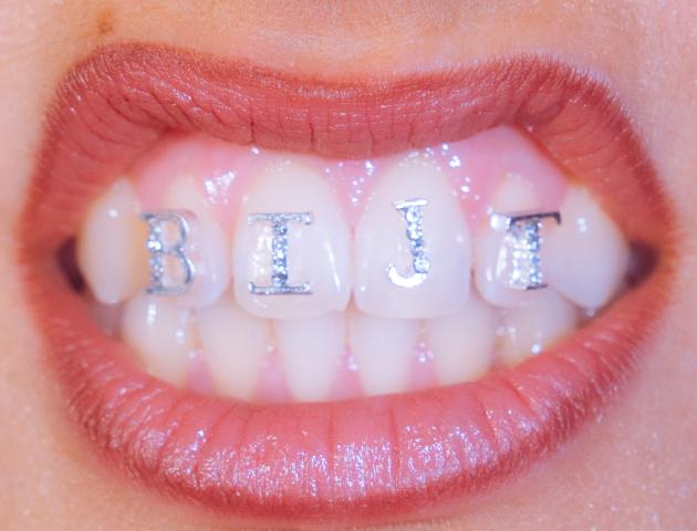 bijt