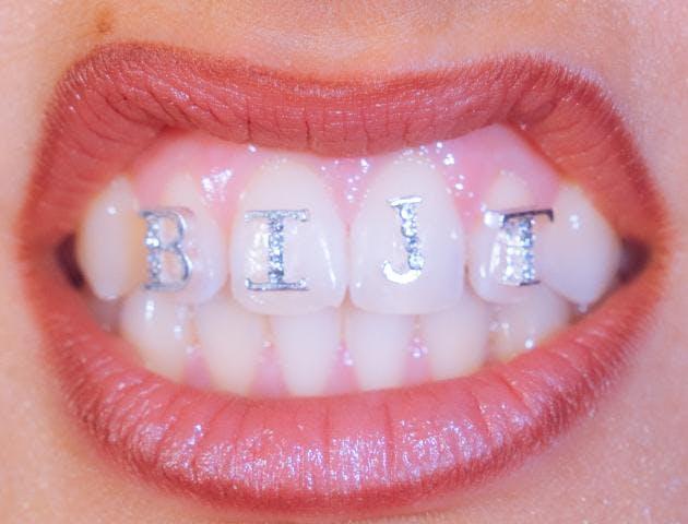 Bijt / Troy © Bijt / Troy
