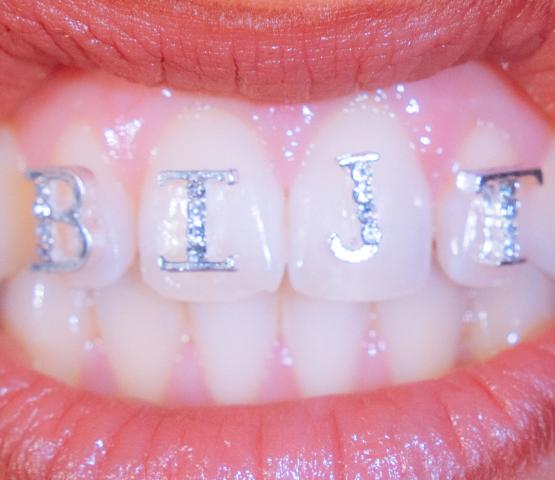 bijt
